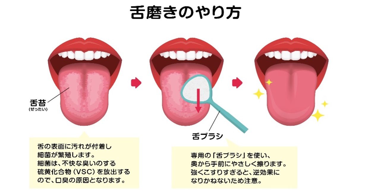 舌磨きのやり方
